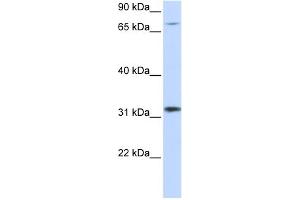 WB Suggested Anti-ZNF799 Antibody Titration:  0.