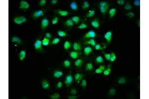 Immunofluorescence staining of Hela cells with ABIN7156000 at 1:166, counter-stained with DAPI. (HMGCS1 antibody  (AA 360-520))