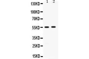 Western blot analysis of ALDH3A2 expression in rat liver extract ( Lane 1) and 22RV1 whole cell lysates ( Lane 2). (ALDH3A2 antibody  (AA 1-100))