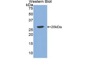 Western Blotting (WB) image for anti-Angiopoietin 1 (ANGPT1) (AA 266-497) antibody (ABIN1171916) (Angiopoietin 1 antibody  (AA 266-497))