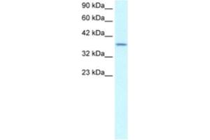 Western Blotting (WB) image for anti-SMAD, Mothers Against DPP Homolog 7 (SMAD7) antibody (ABIN2460353) (SMAD7 antibody)