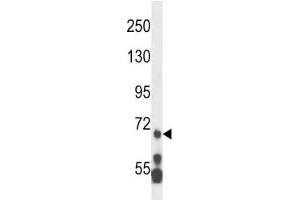 MLL5 antibody western blot analysis in HL-60 lysate.