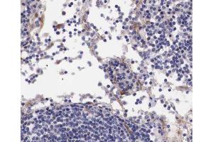ABIN6267676 at 1/100 staining human lymph node tissue sections by IHC-P. (B-Cell Linker antibody  (pTyr96))
