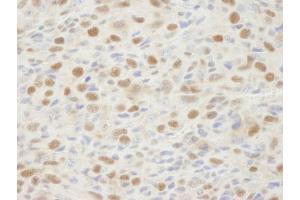 Immunohistochemistry (IHC) image for anti-Mismatch Repair Protein 2 (MSH2) (C-Term) antibody (ABIN7448673) (MSH2 antibody  (C-Term))