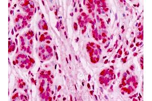 Anti-UBE2D1 / UBCH5 antibody IHC staining of human breast, epithelium. (UBE2D1 antibody  (AA 1-95))