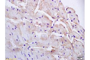 Formalin-fixed and paraffin embedded mouse heart labeled with Anti-PAP2B Polyclonal Antibody, Unconjugated (ABIN754228) at 1:200 followed by conjugation to the secondary antibody and DAB staining (PPAP2B antibody  (AA 241-311))