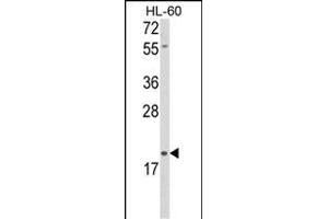 Western blot analysis of DLK2 Antibody (C-term) (ABIN652972 and ABIN2842616) in HL-60 cell line lysates (35 μg/lane). (DLK2 antibody  (C-Term))