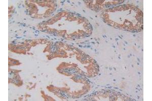 IHC-P analysis of Human Prostate Gland Tissue, with DAB staining. (Kallikrein 2 antibody  (AA 19-261))