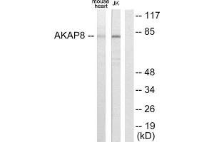 Western Blotting (WB) image for anti-A Kinase (PRKA) Anchor Protein 8 (AKAP8) (Internal Region) antibody (ABIN1848981) (AKAP8 antibody  (Internal Region))