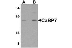 Western blot analysis of CaBP7 in Hela cell lysate with CaBP7 antibody at (A) 1 and (B) 2 μg/ml.