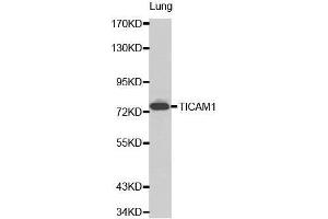 Western Blotting (WB) image for anti-Toll-Like Receptor Adaptor Molecule 1 (TICAM1) (AA 20-200) antibody (ABIN6215259) (TICAM1 antibody  (AA 20-200))