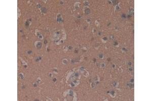 Used in DAB staining on fromalin fixed paraffin- embedded brain tissue (GNaZ antibody  (AA 2-219))