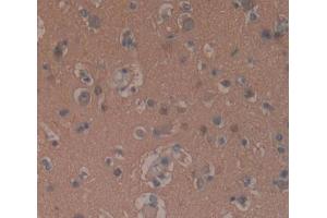 Used in DAB staining on fromalin fixed paraffin- embedded brain tissue (GNaZ antibody  (AA 2-219))