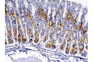 IHC analysis of Periostin using anti-Periostin antibody . (Periostin antibody  (AA 577-810))