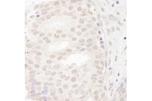 Immunohistochemistry (IHC) image for anti-Cancer Susceptibility Candidate 5 (CASC5) (AA 300-350) antibody (ABIN7448458)