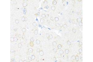 Immunohistochemistry of paraffin-embedded Rat brain using EIF3J Polyclonal Antibody at dilution of 1:100 (40x lens). (EIF3S1 antibody)