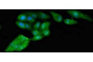 Immunofluorescent analysis of HepG2 cells using ABIN7142559 at dilution of 1:100 and Alexa Fluor 488-congugated AffiniPure Goat Anti-Rabbit IgG(H+L) (RPS4Y1 antibody  (Isoform 1))