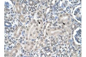 SHMT2 antibody was used for immunohistochemistry at a concentration of 4-8 ug/ml to stain Epithelial cells of renal tubule (arrows) in Human Kidney. (SHMT2 antibody)