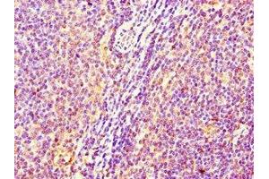 Immunohistochemistry of paraffin-embedded human lymph node tissue using ABIN7175013 at dilution of 1:100 (C17orf58 antibody  (AA 21-90))