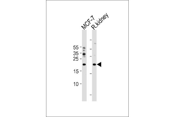 APRT antibody  (C-Term)