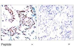 Image no. 1 for anti-Jun Proto-Oncogene (JUN) (Tyr170) antibody (ABIN197133) (C-JUN antibody  (Tyr170))