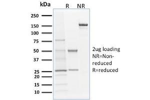 SDS-PAGE Analysis Purified Langerin Mouse Monoclonal Antibody (LGRN/1821). (CD207 antibody  (AA 74-213))