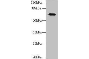 Western blot All lanes: CAPN6 antibody at 5 μg/mL + Human placenta tissue Secondary Goat polyclonal to rabbit IgG at 1/10000 dilution Predicted band size: 75 kDa Observed band size: 75 kDa (Calpain 6 antibody  (AA 195-494))
