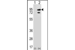 Western blot analysis of SNRK (arrow) using rabbit polyclonal SNRK Antibody (Center) (ABIN652303 and ABIN2841382). (SNRK antibody  (AA 320-349))