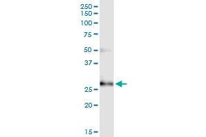 Immunoprecipitation of CCBE1 transfected lysate using anti-CCBE1 MaxPab rabbit polyclonal antibody and Protein A Magnetic Bead , and immunoblotted with CCBE1 purified MaxPab mouse polyclonal antibody (B01P) . (CCBE1 antibody  (AA 1-215))