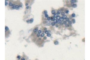 Detection of LSP1 in Rat Small intestine Tissue using Polyclonal Antibody to Lymphocyte Specific Protein 1 (LSP1) (LSP1 antibody  (AA 127-331))