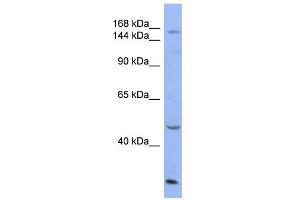 Western Blotting (WB) image for anti-ATPase, Cu++ Transporting, alpha Polypeptide (ATP7A) (Middle Region) antibody (ABIN2778126)