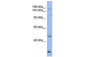 WB Suggested Anti-ATP7A Antibody Titration:  0. (ATP7A antibody  (Middle Region))