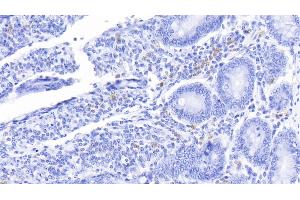 Detection of S100A12 in Bovine Small intestine Tissue using Polyclonal Antibody to S100 Calcium Binding Protein A12 (S100A12) (S100A12 antibody  (AA 2-92))