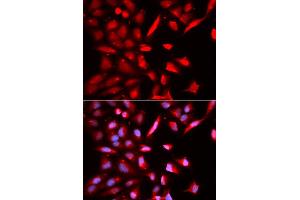 Immunofluorescence (IF) image for anti-Proteasome (Prosome, Macropain) 26S Subunit, ATPase, 3 (PSMC3) antibody (ABIN1874383)