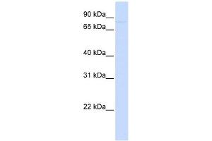 CDH12 antibody used at 1 ug/ml to detect target protein. (Cadherin 12 antibody)
