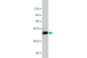 Western Blotting (WB) image for anti-Signal Transducer and Activator of Transcription 1, 91kDa (STAT1) (AA 613-712) antibody (ABIN563024)
