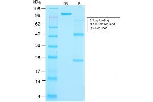 SDS-PAGE Analysis Purified Thyroglobulin Mouse Recombinant Monoclonal Antibody (r2H11). (Recombinant Thyroglobulin antibody)
