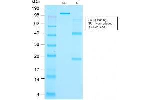 SDS-PAGE Analysis Purified Thyroglobulin Mouse Recombinant Monoclonal Antibody (r2H11).