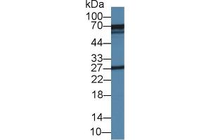 Detection of GLS in Mouse Kidney lysate using Polyclonal Antibody to Glutaminase (GLS) (Glutaminase antibody  (AA 31-253))