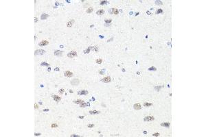 Immunohistochemistry of paraffin-embedded rat brain using CHD1 antibody (ABIN5975217) at dilution of 1/100 (40x lens). (CHD1 antibody)