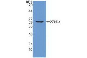 Detection of Recombinant PRSS2, Human using Polyclonal Antibody to Protease, Serine 2 (PRSS2) (PRSS2 antibody  (AA 24-241))
