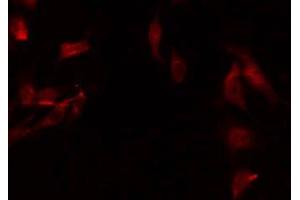 ABIN6275271 staining HuvEc by IF/ICC. (NDUFA8 antibody  (Internal Region))