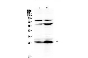 Western blot analysis of Factor D using anti-Factor D antibody .