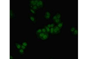 Immunofluorescent analysis of HepG2 cells using ABIN7155891 at dilution of 1:100 and Alexa Fluor 488-congugated AffiniPure Goat Anti-Rabbit IgG(H+L) (HGD antibody  (AA 226-445))