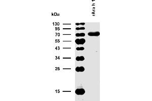 Reactivity of rAra h 1 with sIgE antibodies in plasma of a patient with confirmed presence (routine clinical test) of specific IgE antibodies to peanuts.