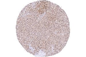 Moderate predominantly cytoplasmic MTAP staining of ovarian stroma cells