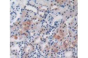 Used in DAB staining on fromalin fixed paraffin- embedded Kidney tissue (LRRC32 antibody  (AA 162-405))