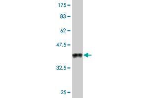 Western Blot detection against Immunogen (38. (Ghrelin antibody  (AA 1-117))