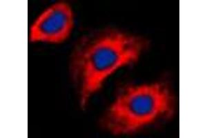 Immunofluorescent analysis of Collagen 3 alpha 1 staining in HeLa cells. (COL3A1 antibody  (N-Term))