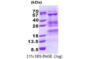 Transcriptional Adaptor 3 (TADA3) (AA 1-432) protein (His tag)